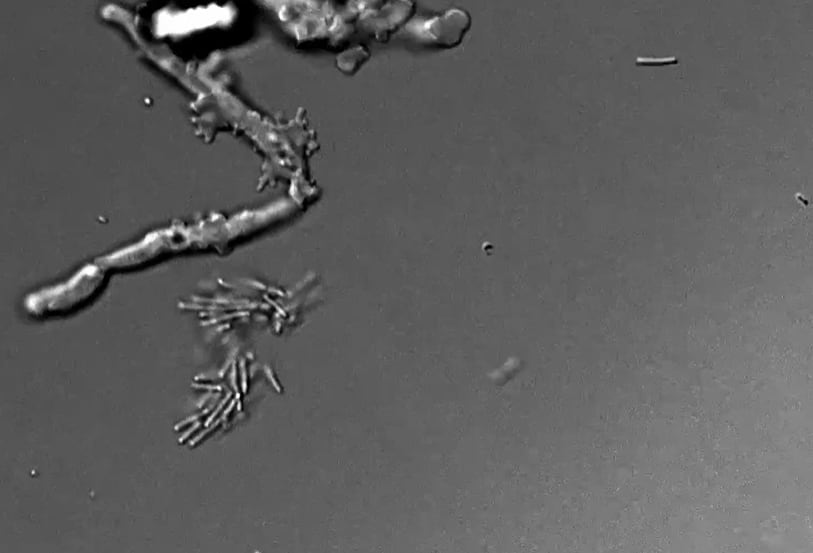 NASA descubre una “ameba de fuego” que rompe un límite que la ciencia creía imposible.