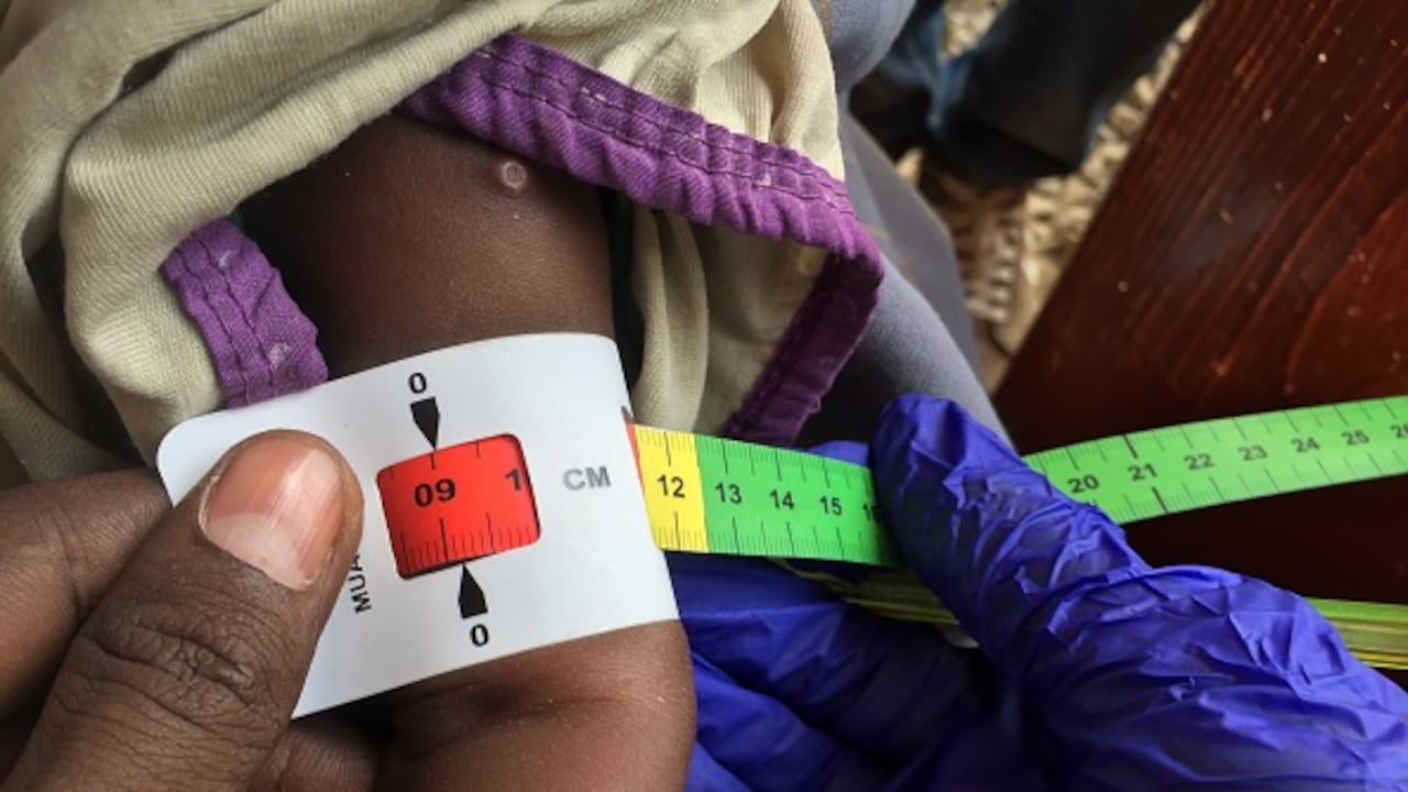 Unicef estima que cerca de 40 millones de niños tienen inseguridad nutricional grave en 15 países.