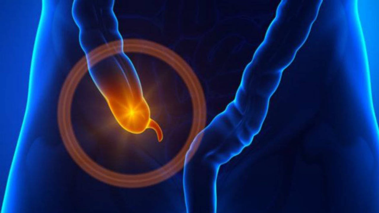 Viviane Labrie, una de las investigadoras que participó en el estudio, recalcó que no recomienda a la gente extirparse este órgano.