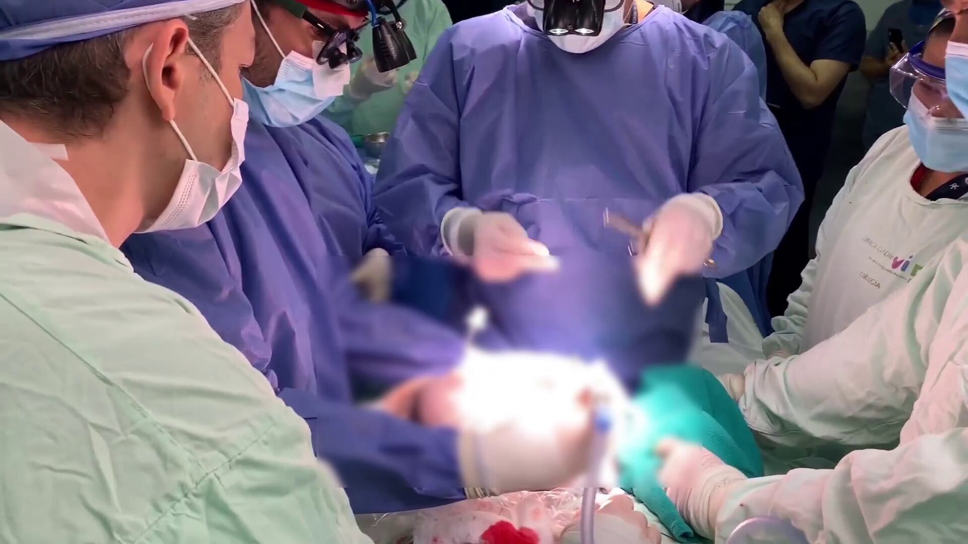 Este procedimiento es el primero registrado en Latinoamérica y el segundo en el mundo