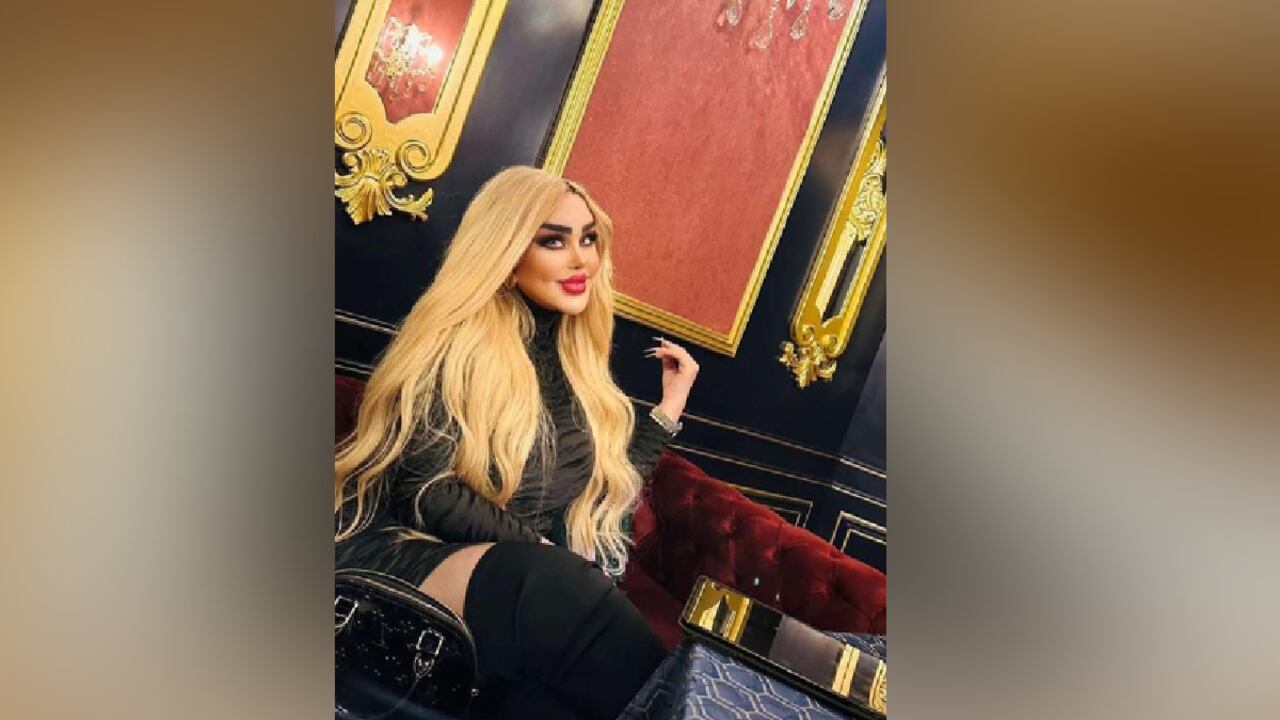 La mujer se ha practicado cerca de 43 intervenciones en el rostro.