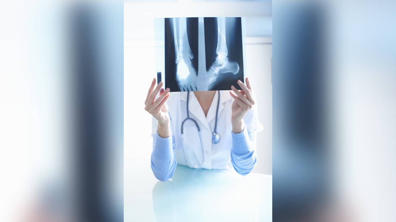 El calcio es crucial para la buena salud de los huesos.