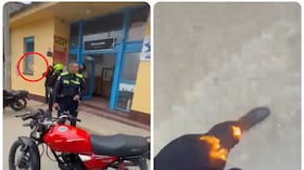 Capturan a motociclista que incendió la pierna a agente de tránsito en Guasca.