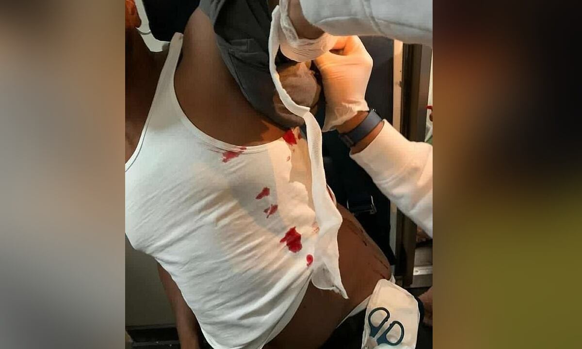 Vuelo de British Airways, se convirtió en escenario de pelea con botella 'despicada'