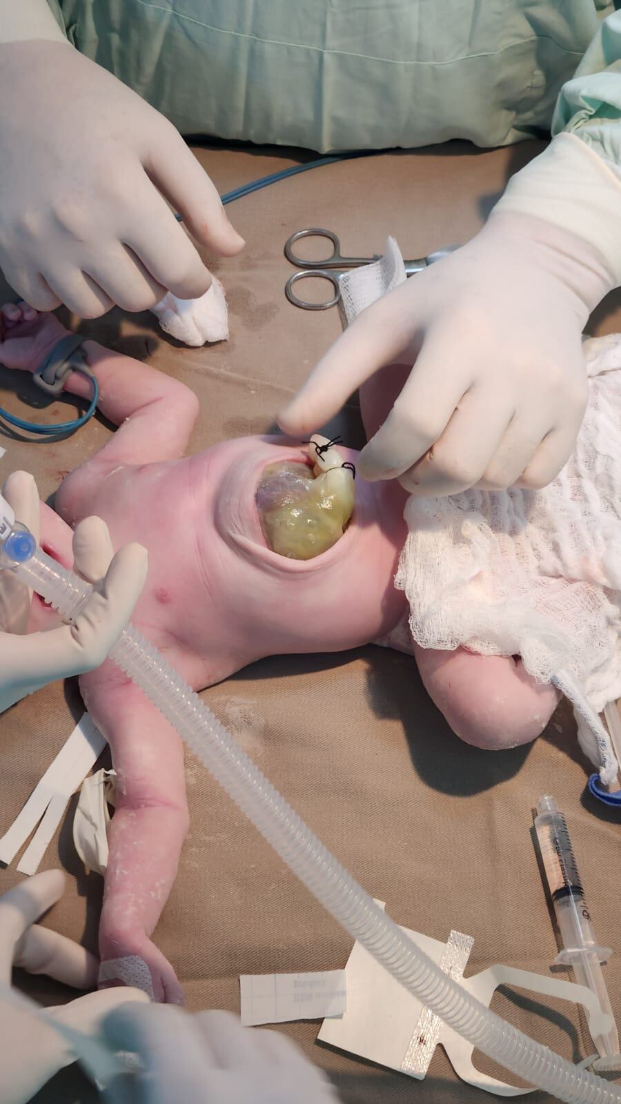 Así fue la operación.