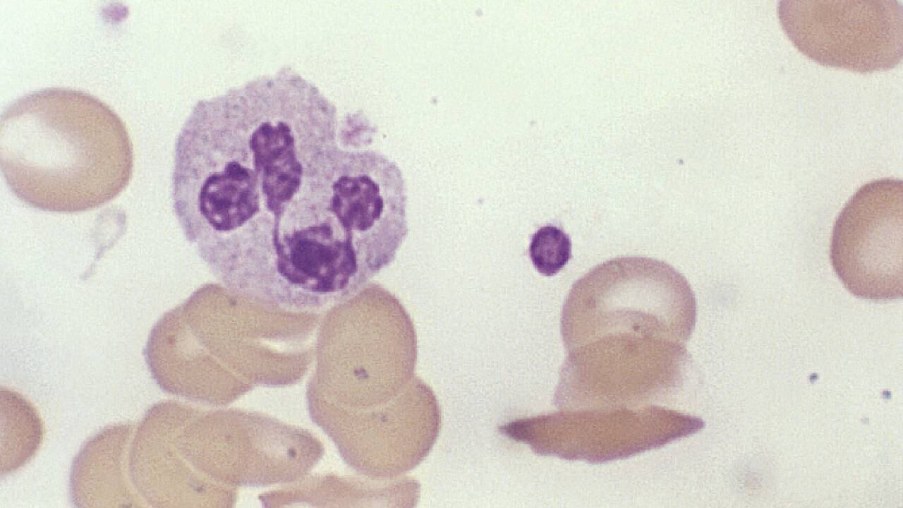 Una alimentación balanceada es ideal para aumentar los glóbulos blancos. Foto: Getty images.