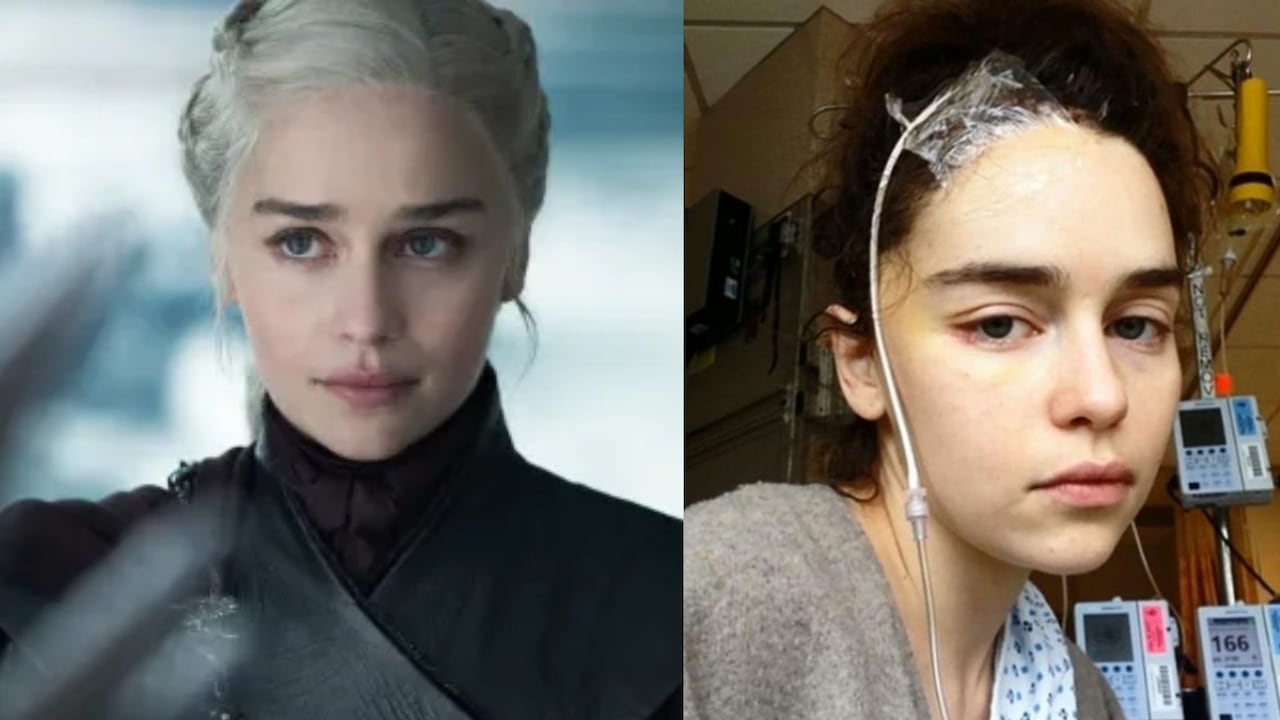 Emilia Clarke y las secuelas de sus dos hemorragias cerebrales