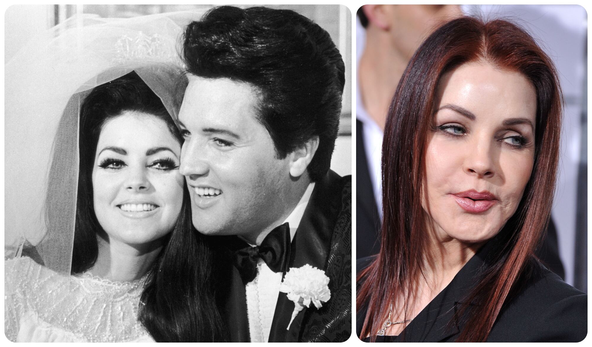 Fue víctima de un estafador que le inyectó en el rostro una silicona que se usa para lubricar partes de autos.