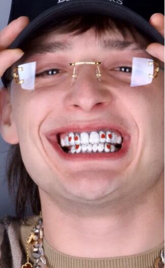 El cantante mandó a hacer una dentadura postiza de diamantes