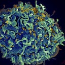 Esta imagen de microscopio electrónico proporcionada por los Institutos Nacionales de Salud de EE. UU. muestra una célula T humana, en azul, atacada por el VIH, en amarillo, el virus que causa el SIDA. Tres mujeres a las que se les diagnosticó VIH después de someterse a procedimientos “faciales vampíricos” en un spa médico no autorizado de Nuevo México son las primeras que se cree que contrajeron el virus a través de un procedimiento cosmético con agujas, según funcionarios federales de salud.