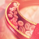 La trombosis es la tercera causa de muerte a nivel mundial