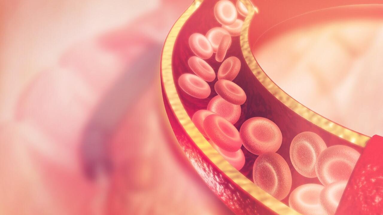 La trombosis es la tercera causa de muerte a nivel mundial