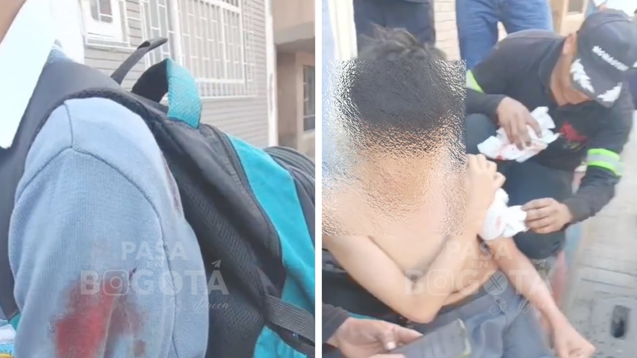 Menor de 15 años herido en uno de sus brazos tras ser asaltado cerca de su colegio en Bogotá