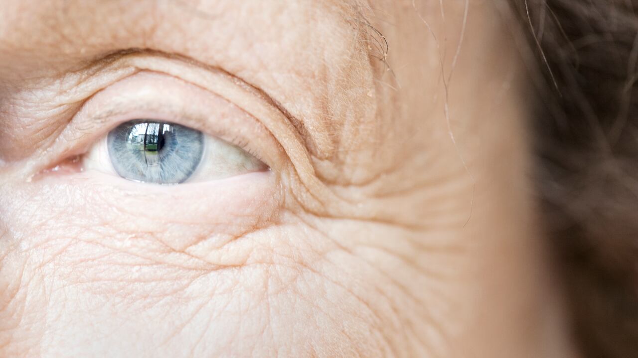 Las arrugas y las líneas de expresión son signos de la edad; y de falta de colágeno.