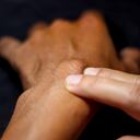 La aparición de protuberancias en las manos requiere de atención médica.