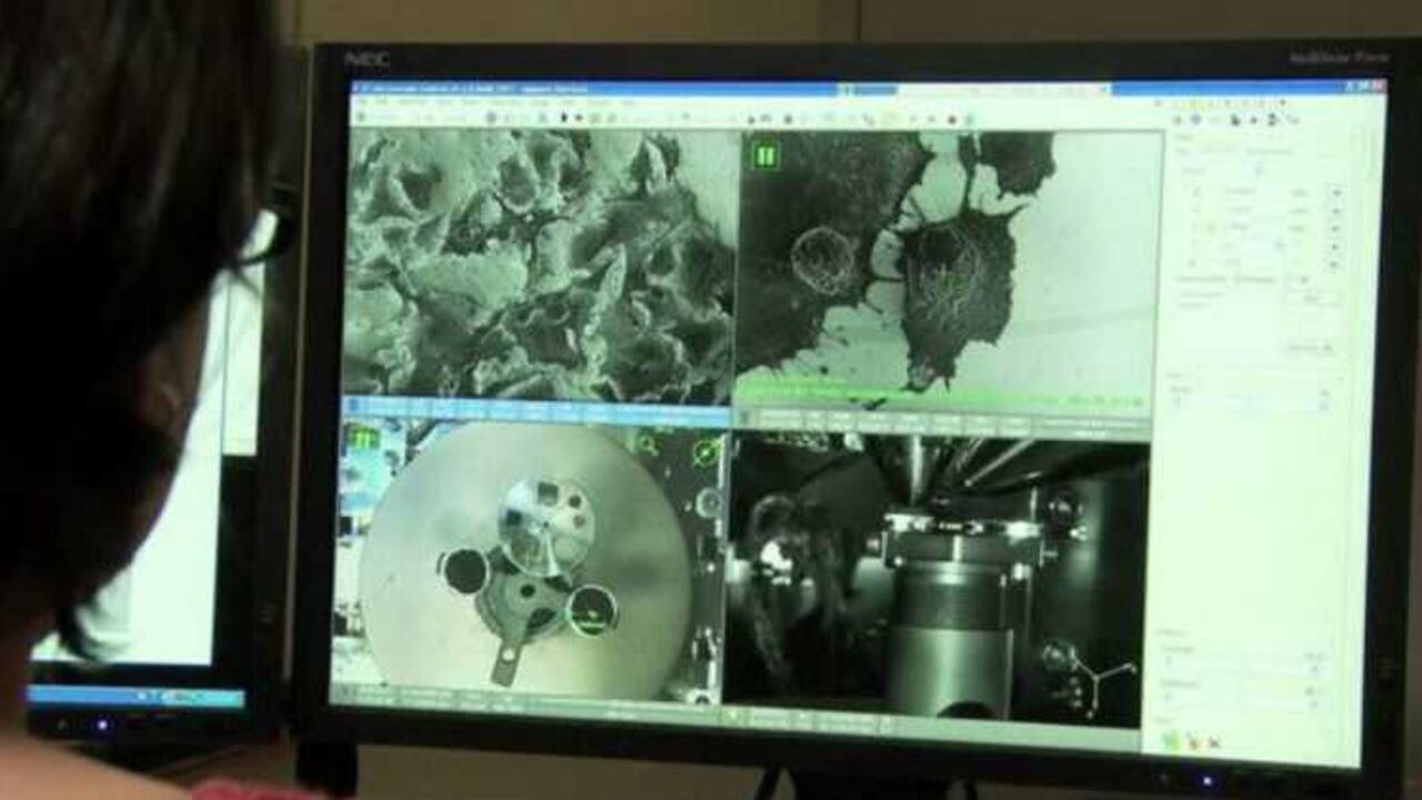 El estudio se hizo con 400 pacientes de los reclutados para comparar las biopsias liquidas y las de tejido.