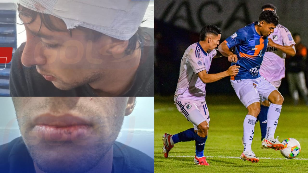 Jacobo Pimentel habría sido golpeado por rivales de Millonarios al término del juego en Tunja