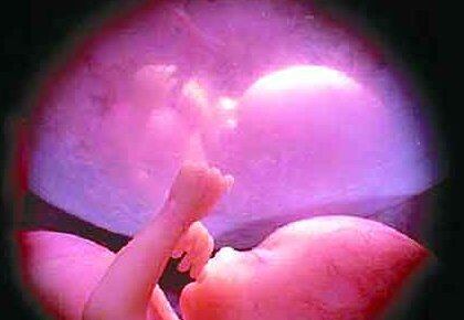 Por lo general, la formación de fetos en el organismo de los bebés se nota a simple vista, pues les causa un hinchazón en determinadas zonas del cuerpo.