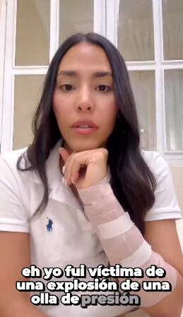 Debbie Alflalo, ex Miss República Dominicana sufrió accidente casero en la cocina