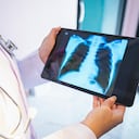 Casos de tuberculosis en Colombia