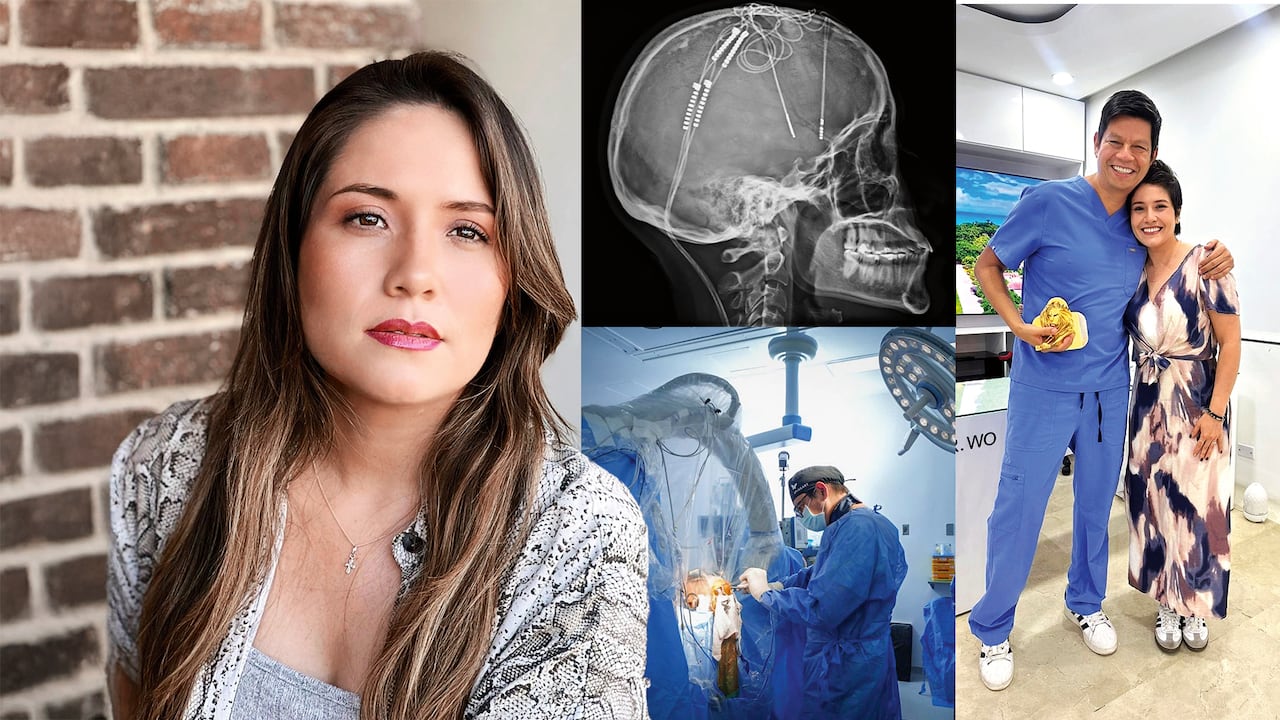 Lorena Rodríguez Moreno recibió una intervención de estimulación cerebral profunda.