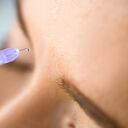 El ácido hialurónico debe ser inyectado por un profesional de la salud.