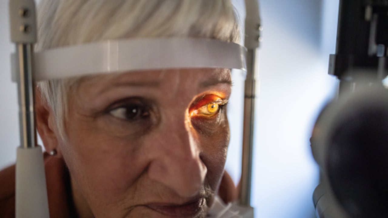 Las cataratas son una causa muy común de pérdida de la visión en las personas.