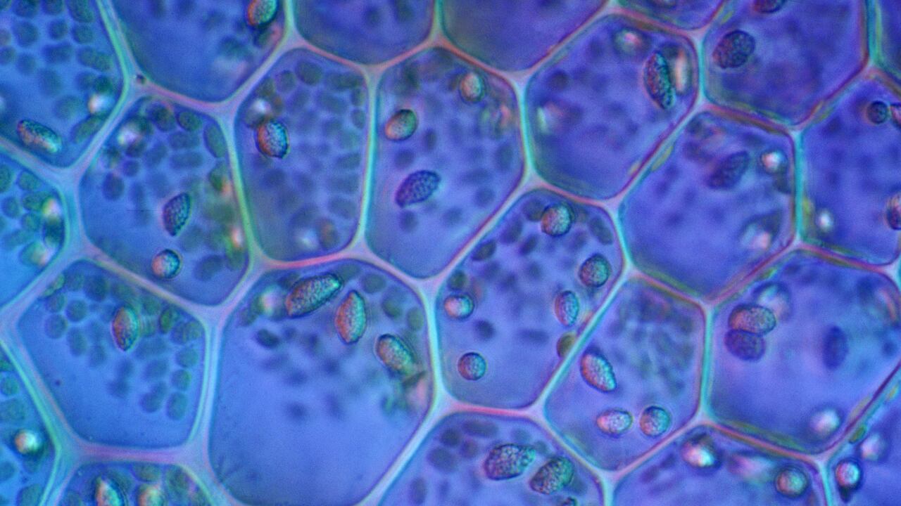 Bacteria
