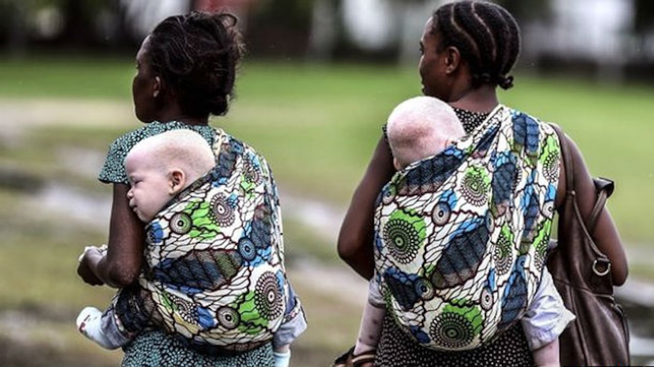 En Tanzania, es generalizada la creencia de que los albinos traen mala suerte, son hijos del demonio o producto de un adulterio.
