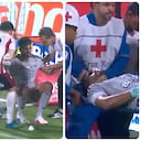 Mauro Silveira recibió un golpe en su rostro finalizando el partido contra el Medellín.