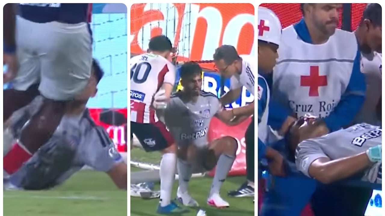 Mauro Silveira recibió un golpe en su rostro finalizando el partido contra el Medellín.