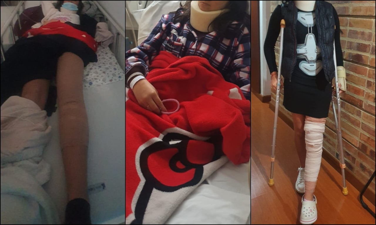 Fotos de la presunta víctima, según denuncia, después de haber sido empujada por las escaleras del GCB