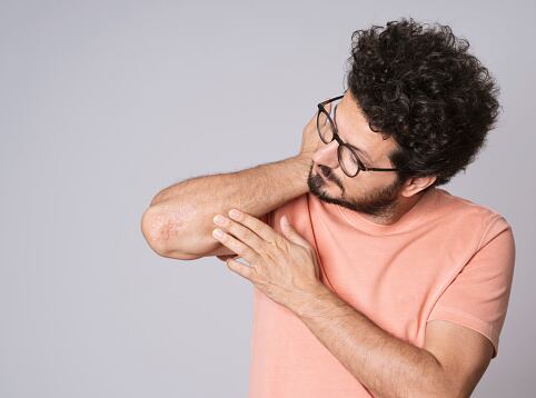 El Síndrome de Sjögren causa codos y ojos secos.