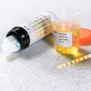 Representación de ácido úrico