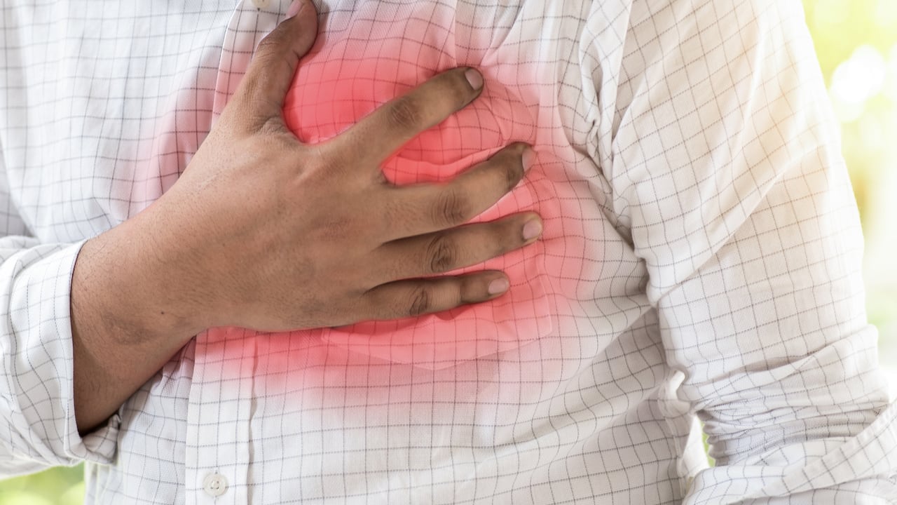 El infarto puede manifestarse de diferentes formas. (Imagen de referencia).