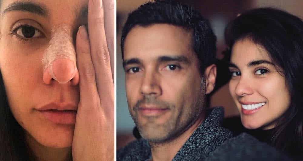Producto del violento ataque de su entonces pareja Alejandro García, la joven actriz vallecaucana sufrió fractura en la nariz, lesiones en la órbita del ojo y en los labios. 