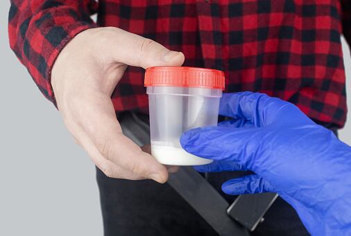 La donación de esperma es un proceso voluntario.