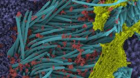 Una imagen de aumento de mayor potencia muestra la estructura y densidad de los viriones del Sars-CoV-2 (de color rojo) producidos por los epitelios de las vías respiratorias humanas. Los viriones son la forma infecciosa completa del virus liberado a las superficies respiratorias por las células huésped infectadas.