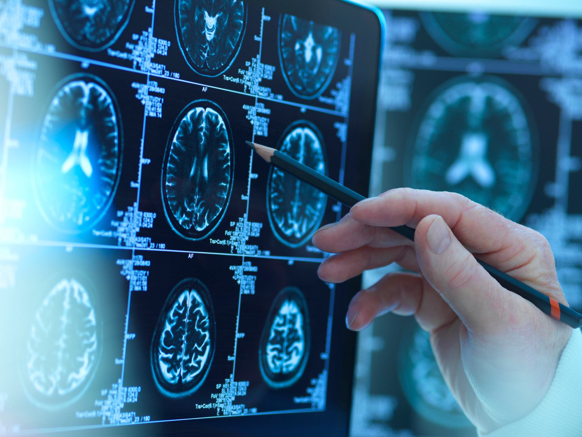 Foto de referencia sobre el análisis del cerebro