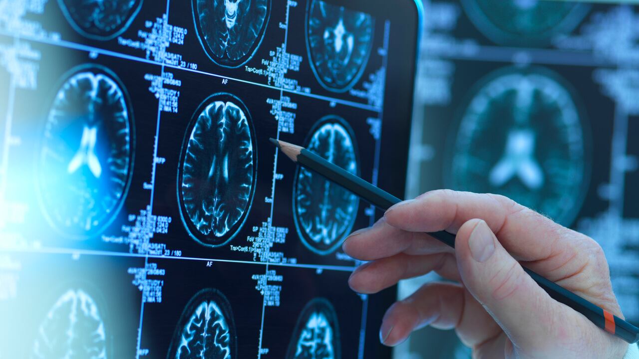 Foto de referencia sobre el análisis del cerebro