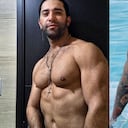 Edwin Garrido se va en contra de Yeferson Cossio luego de anunciara su cirugía de alargamiento de piernas