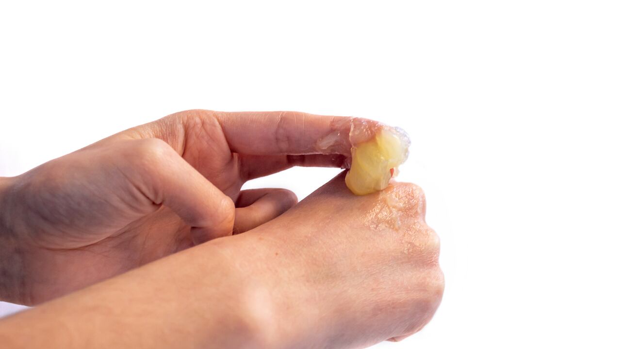 Se considera como un producto 'multiusos'. Foto: Getty Images.