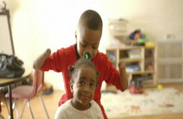 El niño tuvo que aprender a comer, escribir e incluso jugar videojuegos sin las manos. Harvey dijo que quería someterse a la operación para poder cargar a su hermana y jugar con la pelota. 