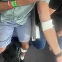 Un pasajero muestra sus heridas tras el incidente