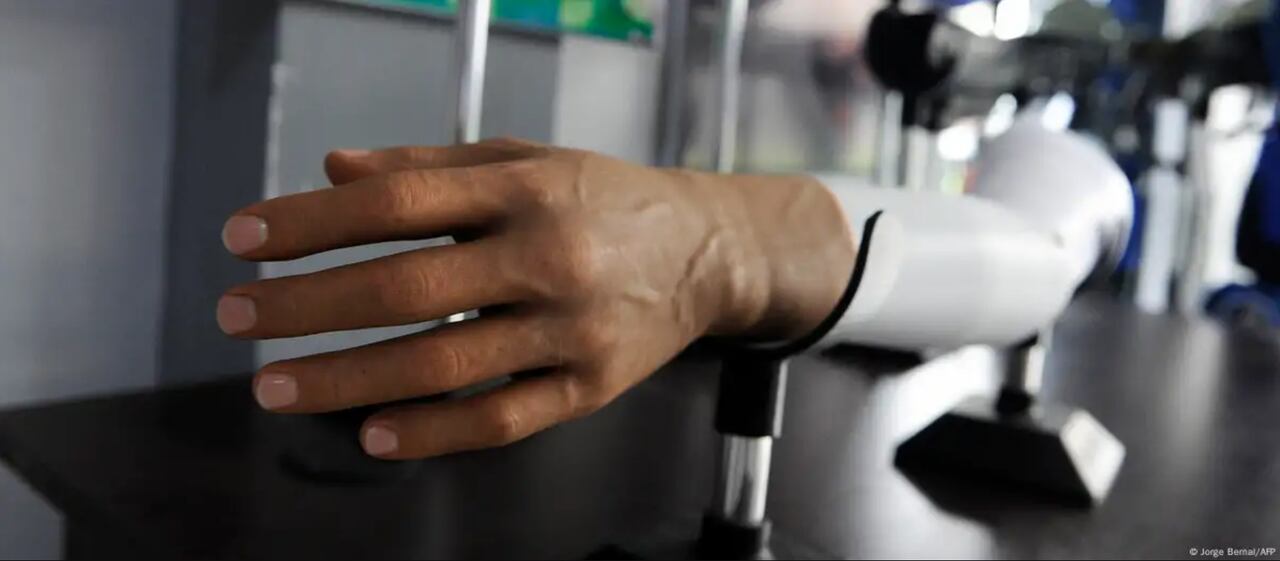 Robots con más de 860.000 vías sensoriales se acercan a la sensibilidad humana.