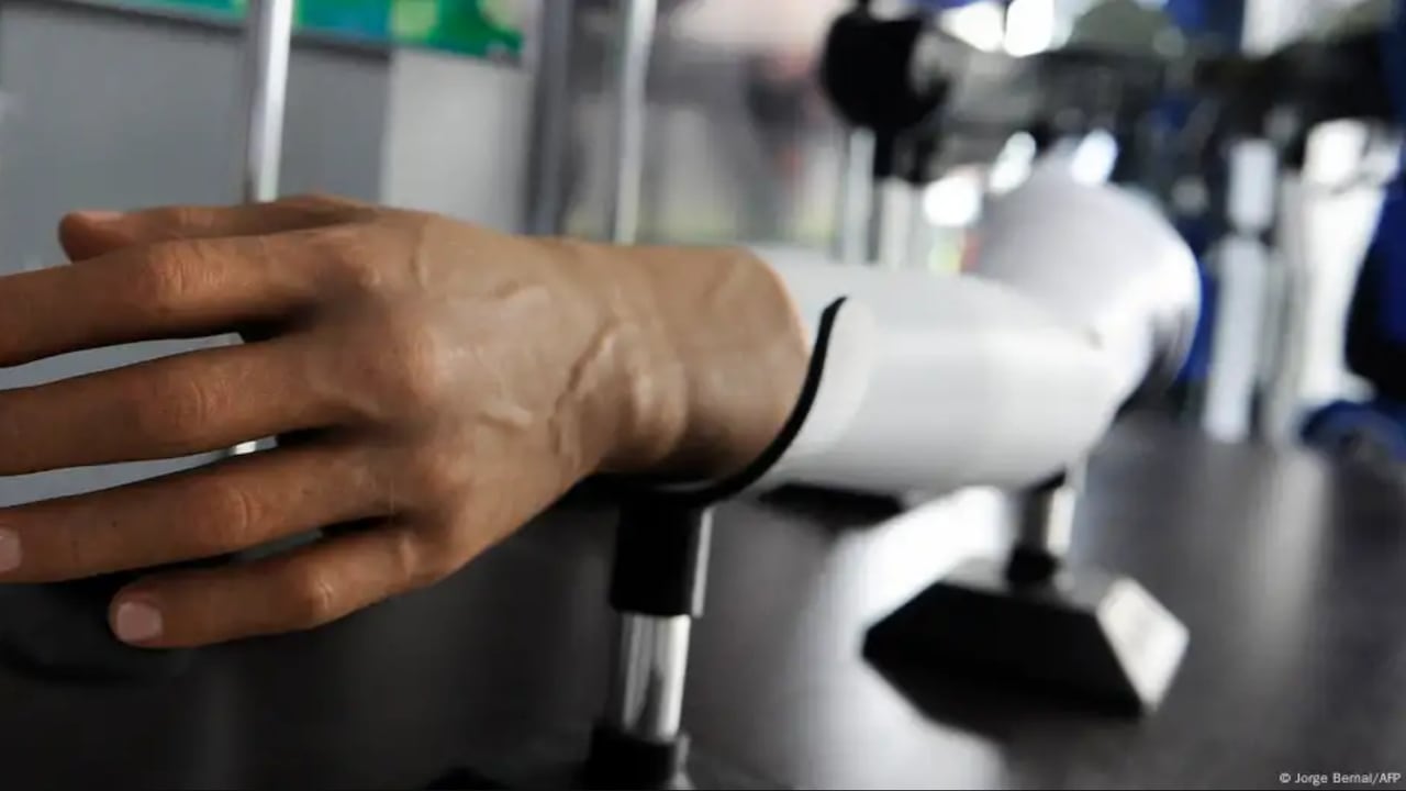 Robots con más de 860.000 vías sensoriales se acercan a la sensibilidad humana.