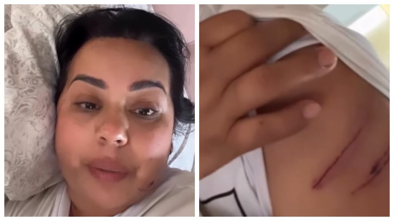 La mamá de Yina Calderón, Merly Ome, sufrió un accidente mientras conducía moto.