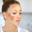 Dark spots, freckles,hyperpigmentation(melasma or chloasma)