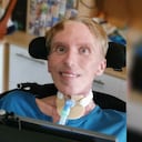 Muere a los 64 años el científico que se convirtió en el primer “cyborg” del mundo