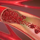 Es importante mantener una dieta balanceada para cuidar las arterias.